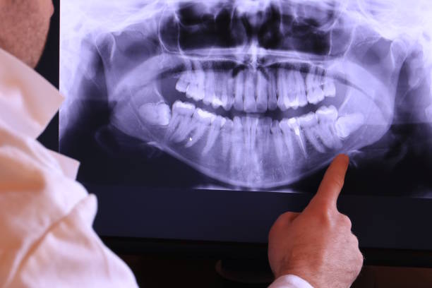 Best Emergency Gum Pain Relief  in Grandview, TX