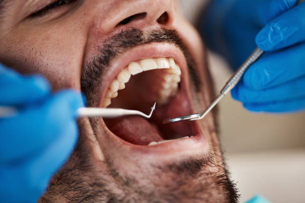 Best Cracked Tooth Emergency Dentist  in Grandview, TX